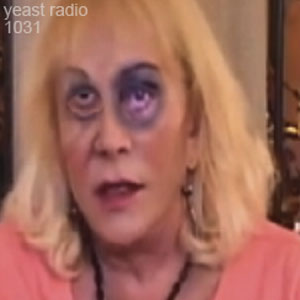 Yeast Radio 1031 You Goatse My Head